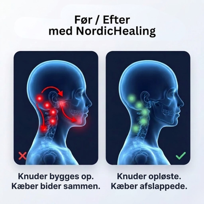 NordicHealing - Lindre spændinger i ryg og nakke derhjemme